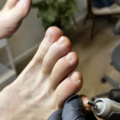 Detaljeret fodpleje med elektrisk slibning af tånegle