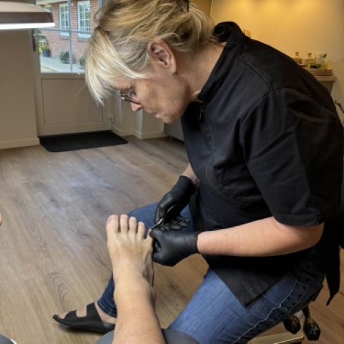Fodplejer klipper tånegle under behandling i klinik